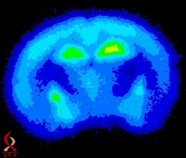 Bio-X PET scan brain image